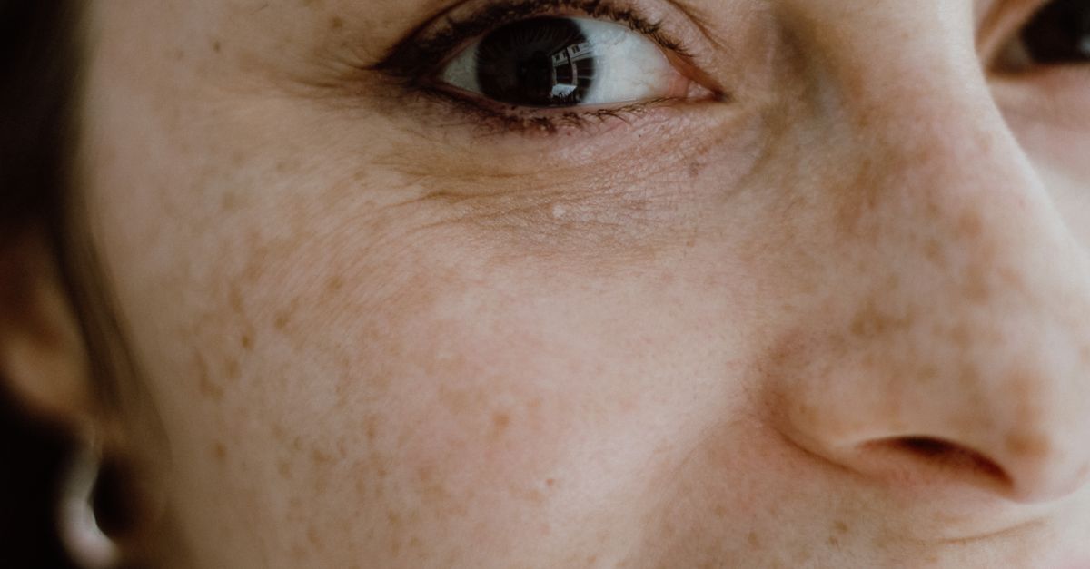 A close-up of a face turned toward the light, freckles and fine skin texture visible.