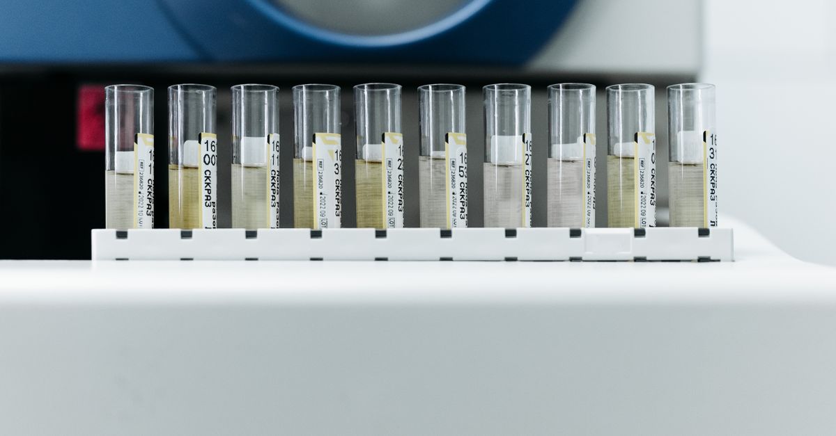 A rack of labelled test tubes holds pale liquid at equal levels.